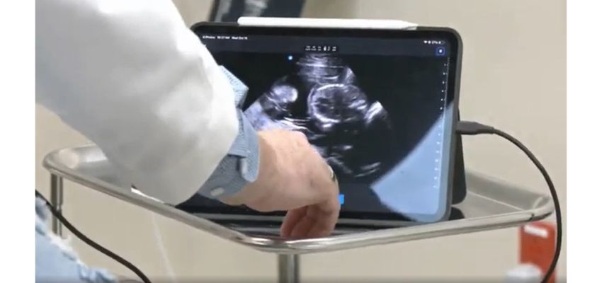 Close-up of a tablet displaying an ultrasound image while a clinician’s hand adjusts the device on a metal tray.