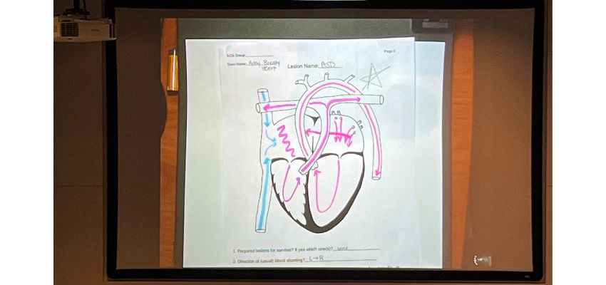 A projected anatomical heart diagram with labeled blood flow pathways displayed during a lecture.
